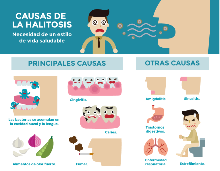 causas de la halitosis
